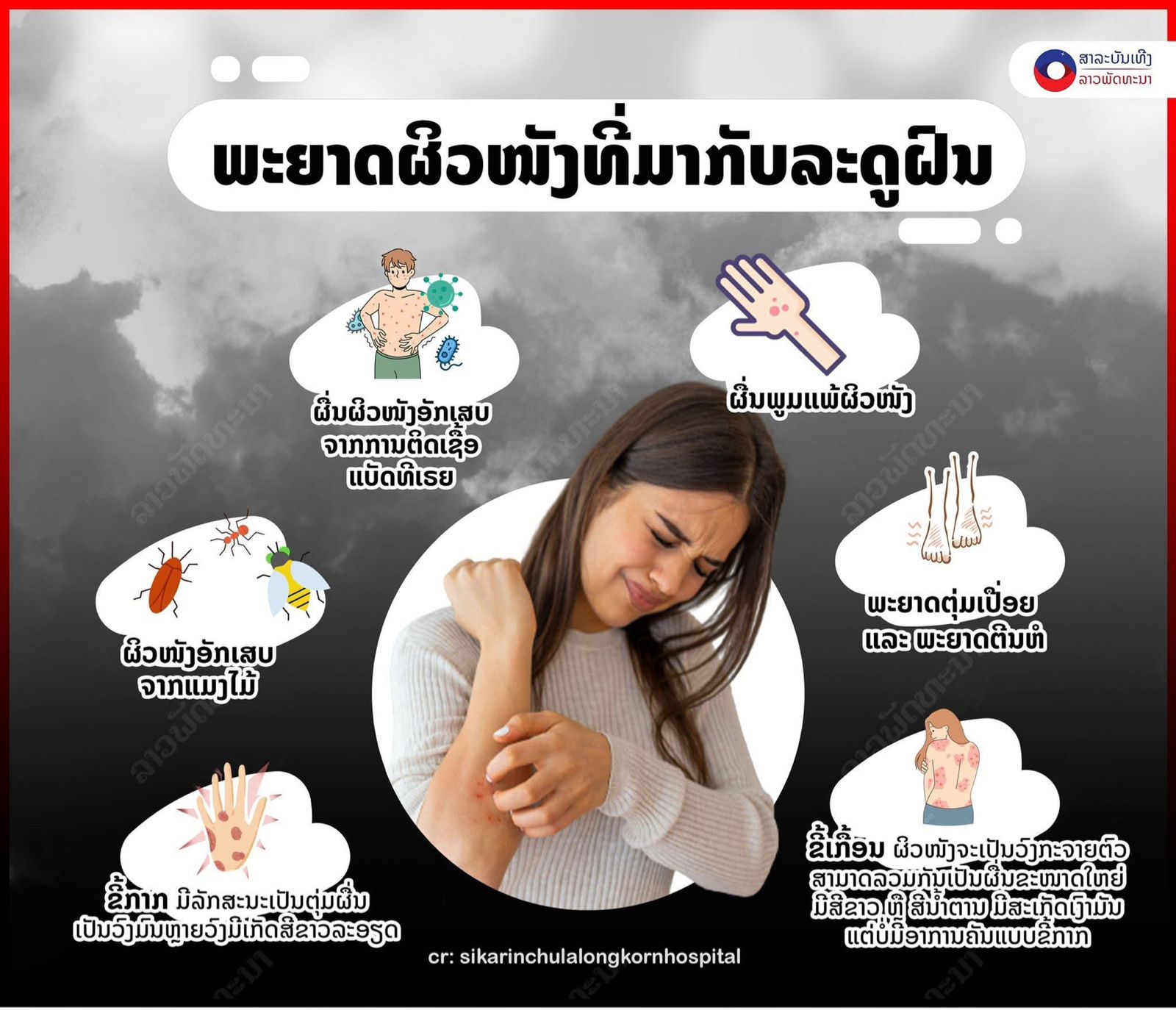 ພະຍາດຜິວໜັງທີ່ມາກັບລະດູຝົນ.